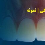 پایان نامه دندانپزشکی